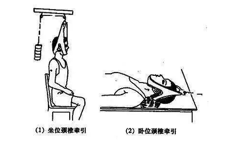 不少人喜欢把头用牵引装置吊起来做运动，这种“吊颈健身”。