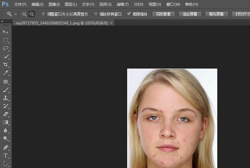 关于用PS消除脸上痘痘，立马无影踪