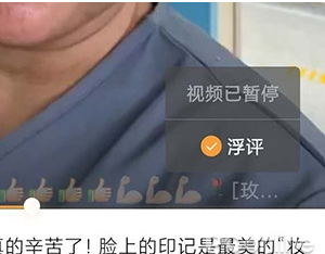 微信安卓内测版7.0.17更新了什么