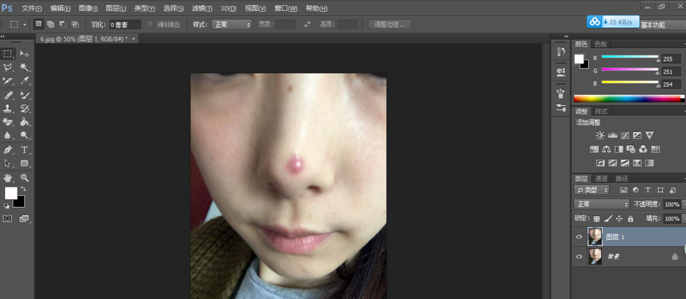 去除照片痘印很简单,先来两种方法