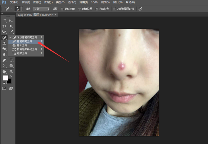 去除照片痘印很简单,先来两种方法