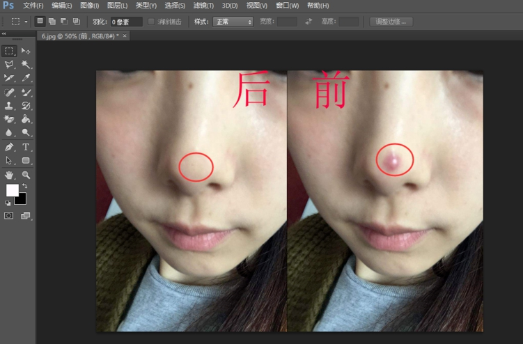 说说6使用Photoshop为图片人物去痘印操作方法介绍