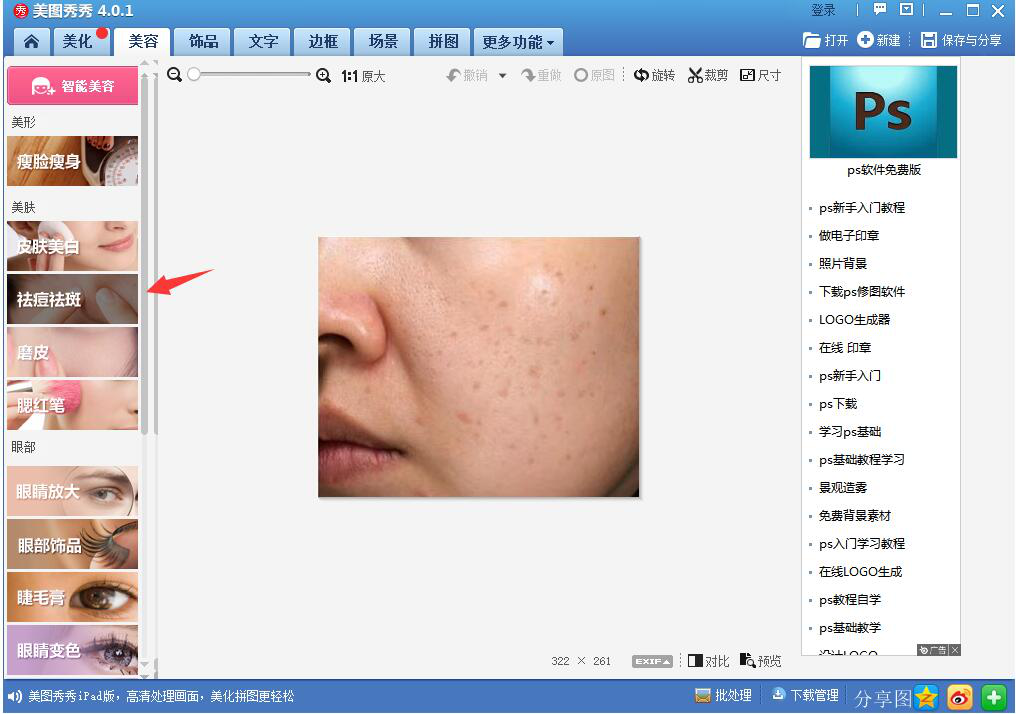 我来说说体验美图秀秀人像处理功能,轻松消除痘痘斑点。