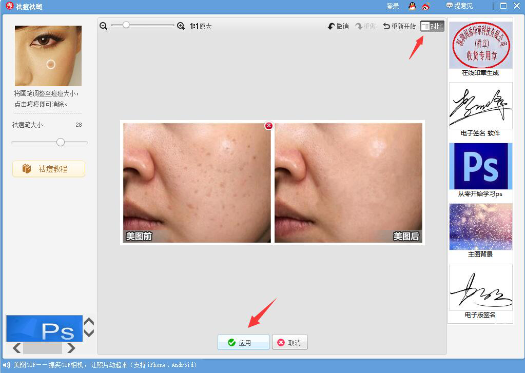 我来说说体验美图秀秀人像处理功能,轻松消除痘痘斑点。