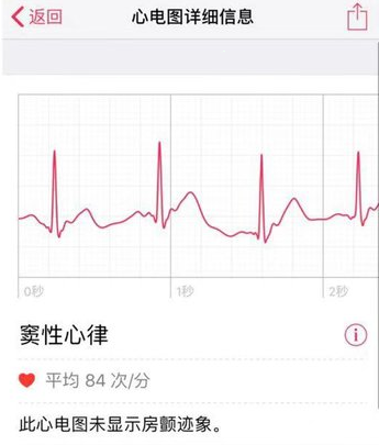 小编教你Apple Watch怎样查看心电图。